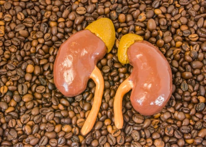 impact of caffeine in kidney stone