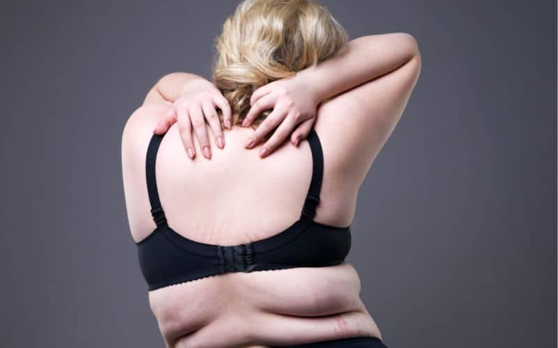 woman weight gain can scoliosis worse