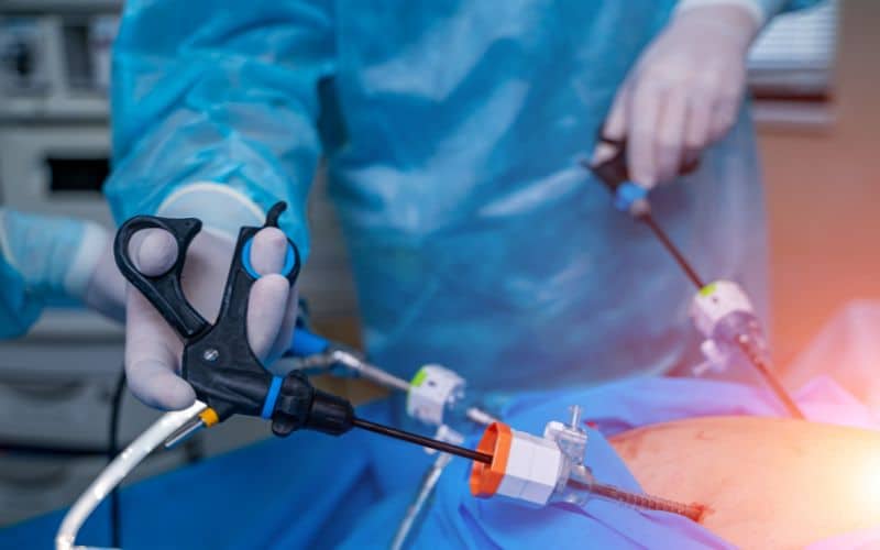 Bariatric Surgery modern equipment