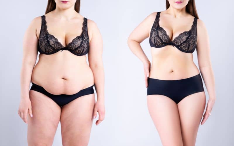 Impact on Body Weight After Breast Reduction