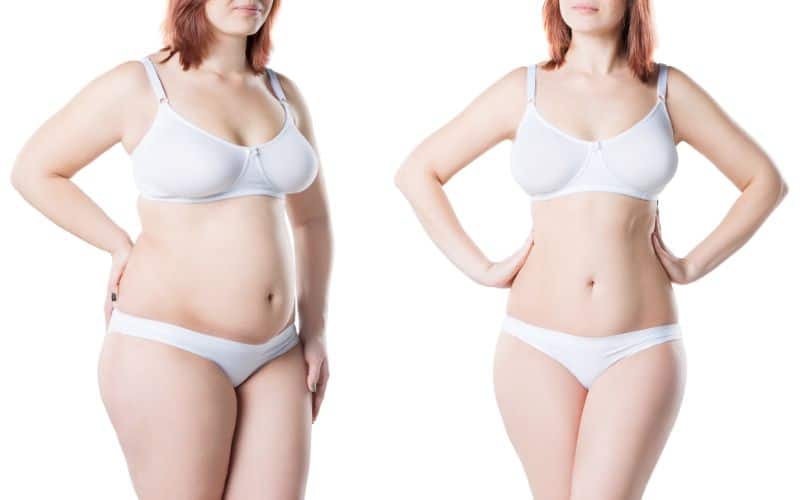 Weight Loss and Breast Reduction