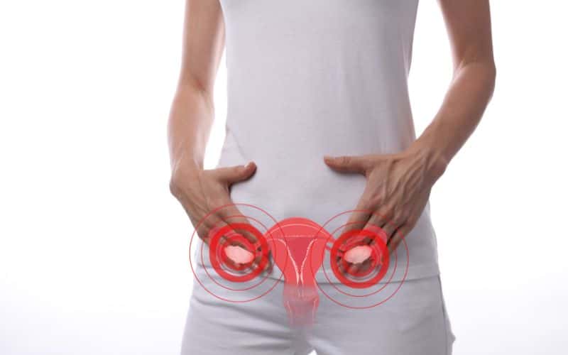 Polycystic ovary syndrome Gynecology , female health and anatomy concept